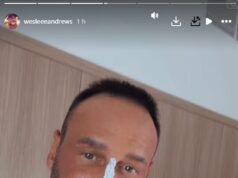 Il nuovo marito di Katie Worth, Lee Andrews, si fa “aggiustare” il naso e il mento mentre la coppia si riunisce in una clinica di cosmetici dopo che lei è tornata a Dubai (e lei non può resistere a un po’ di Botox!)