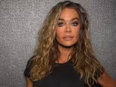 Denise Richards è sincera riguardo al suo intervento di lifting