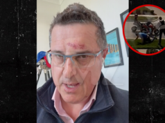 La star di “Reacher” Alan Ritchson, vittima di un combattimento, spiega perché ha iniziato a mangiare carne di manzo