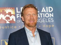 Kevin McKidd e Kim Raver lasciano Gray’s Anatomy