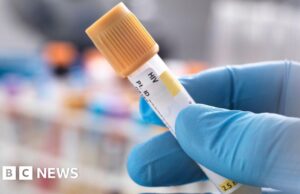 Genitori accusati di aver nascosto l’infezione da HIV della figlia e di averla trascurata