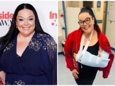 Lisa Riley è corsa in ospedale dopo che una “brutta caduta” l’ha costretta a necessitare di un intervento chirurgico