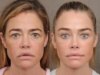 Denise Richards ha rivelato il suo restyling e non è una vittoria per la trasparenza