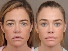 Denise Richards ha rivelato il suo restyling e non è una vittoria per la trasparenza
