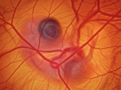 Come si fotografa una gallina dentro un uovo?