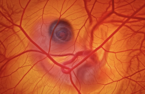 Come si fotografa una gallina dentro un uovo?