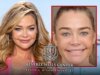 Le foto prima e dopo di Denise Richards stanno dando una spinta alla sua attività di chirurgo