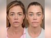 Denise Richards presenta la trasformazione “scioccante” del lifting nelle foto prima e dopo
