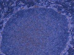 Il Giappone approva il primo trattamento al mondo realizzato con cellule umane riprogrammate