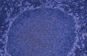 Il Giappone approva il primo trattamento al mondo realizzato con cellule umane riprogrammate