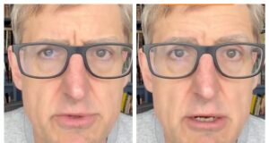 Louis Theroux fornisce aggiornamenti sulla sua salute dopo che i suoi capelli hanno iniziato a cadere