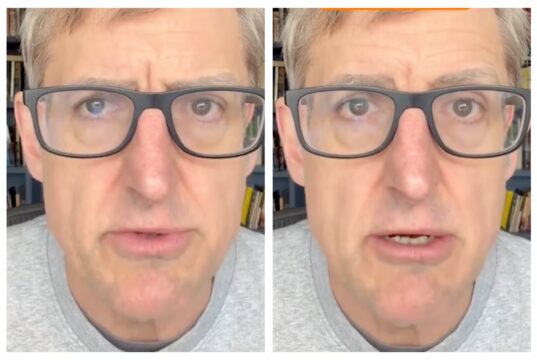 Louis Theroux fornisce aggiornamenti sulla sua salute dopo che i suoi capelli hanno iniziato a cadere