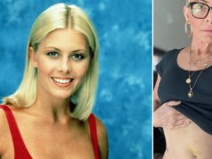 La star di “Baywatch” Nicole Eggert viene sottoposta a un importante intervento chirurgico contro il cancro dopo i risultati allarmanti dei check