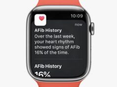 La funzione Cronologia AFib di Apple Watch viene lanciata nella Cina continentale