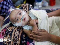 Perché il Bangladesh sta assistendo a un picco mortale di morbillo