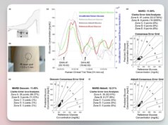 Il MIT mostra la tecnologia dei sensori che consente il monitoraggio della glicemia sugli smartwatch