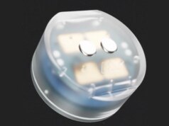 Questo piccolo impianto cerebrale potrebbe curare la depressione a casa