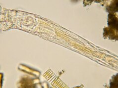 Gli scienziati fanno rivivere un antico “verme zombi” di 24.000 anni fa dal ghiaccio artico, poi si è riprodotto