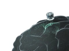Un impianto cerebrale per la depressione sta per essere testato sugli esseri umani