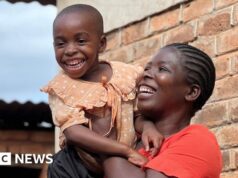 “La adoro adesso”: la madre impara advert affrontare l’autismo del bambino in un paese con poco aiuto