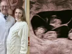 “Una su 15,5 milioni”: una donna russa dà alla luce quattro bambine identiche