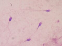 Una startup dello Utah afferma che il suo sperma coltivato in laboratorio può produrre embrioni, in una potenziale svolta nella fertilità