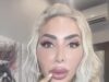 Farrah Abraham ora non riesce advert aprire completamente la bocca… dopo aver speso quasi 1 milione di dollari in interventi di chirurgia estetica