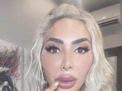 Farrah Abraham ora non riesce advert aprire completamente la bocca… dopo aver speso quasi 1 milione di dollari in interventi di chirurgia estetica
