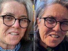 Rosie O’Donnell, 64 anni, rivela un lifting segreto “vergognoso”… dopo aver definito l’intervento chirurgico un “tradimento del femminismo”
