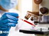 Il Brasile monitora due pazienti per possibile infezione da Ebola